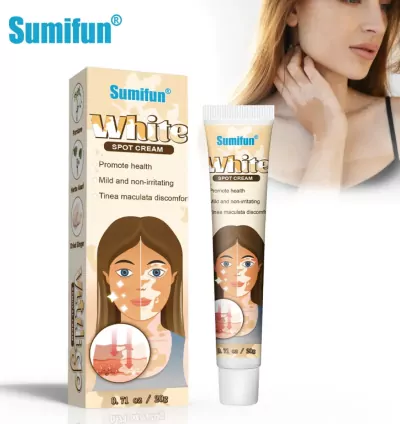 Vitiligo Removal Cream 20gm