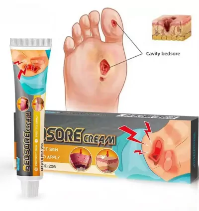 Sumifun Bedsore Treatment Cream 20gm