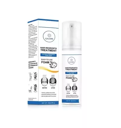 Fixxie Hair Regrowth Minoxidil Foam For Anti Hair Loss And Hair Regrowth